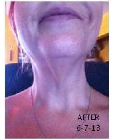 Firm Up Neck Chest & Upper Arm Firming Serum 5.7oz - Best Anti-Aging Solution for Youthful Skin | International Shipping Available - Buy Online on GoSupps.com