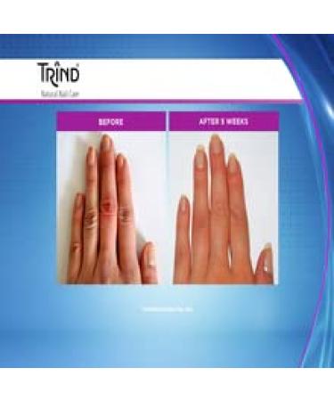 Trind Keratin Restorer Nail Strengthener 9ml - Repair and Strengthen Damaged Nails - Buy Online on GoSupps.com