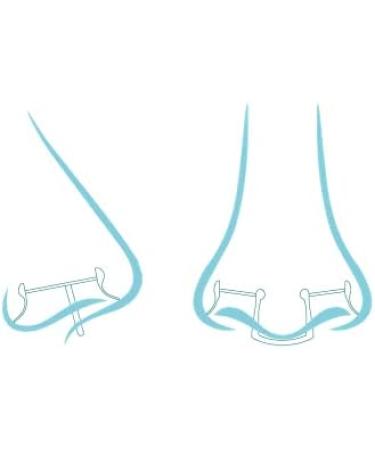 Nosa All-Energy Nasal Filter - Prevents Pollen Pet Allergies Dust & Mold | 7 Series Package to Reduce Allergic Reactions | International Shipping Available - Buy Online on GoSupps.com