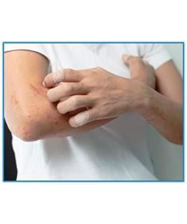 KeriCure Natural Seal Targeted Pain Relief for Kids 1oz - Soothing Hydrogel for Cold Sores, Rashes, and Insect Bites - Made in USA - Woman Owned Business - Buy Online on GoSupps.com