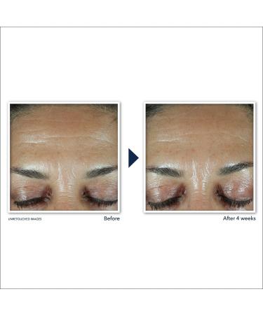 RoC Retinol Correxion Anti-Wrinkle Retinol Face Serum with Hyaluronic Acid 1.0 oz - Transform Your Style with the Best Innovation Today! - Buy Online on GoSupps.com