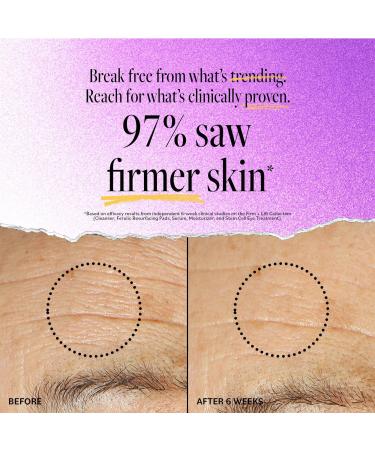 Discover DERMA E Ultra Lift Firming DMAE Moisturizer 2.0 oz - Elevate Your Style Instantly! - Buy Online on GoSupps.com