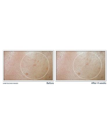 RoC Even Tone & Lift Day Moisturizer SPF 30 1.7 oz - Transform Your Style with the Best Innovation Today! - Buy Online on GoSupps.com