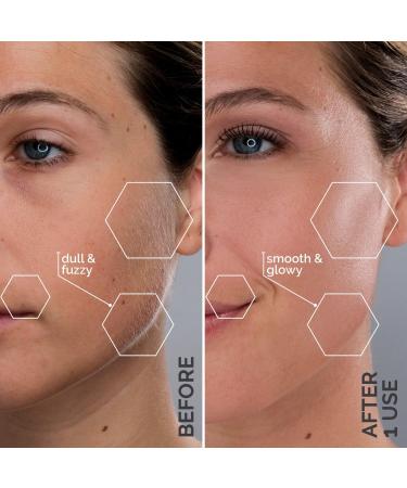 Michael Todd Beauty Sonicsmooth Dermaplaning Replacement Kit - Discover Premium Quality Shop now! - Buy Online on GoSupps.com