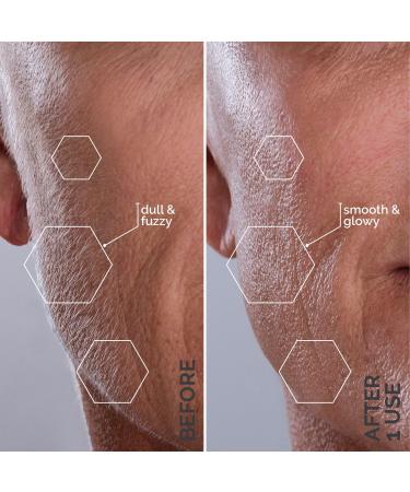 Michael Todd Beauty Sonicsmooth Dermaplaning Replacement Kit - Discover Premium Quality Shop now! - Buy Online on GoSupps.com