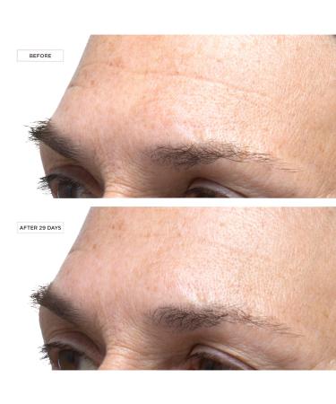 Perricone MD Cold Plasma Plus+ Advanced Serum Concentrate 1.0 oz - Discover Premium Quality Shop now! - Buy Online on GoSupps.com