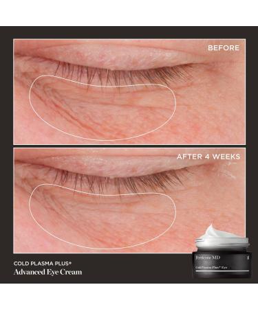 Perricone MD Cold Plasma Plus+ Eye 0.5 oz - Transform Your Style with the Best Innovation Today! - Buy Online on GoSupps.com