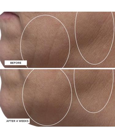 Discover Perricone MD High Potency Classics Hyaluronic Intensive Moisturizer 1 oz - Elevate Your Style Instantly! - Buy Online on GoSupps.com