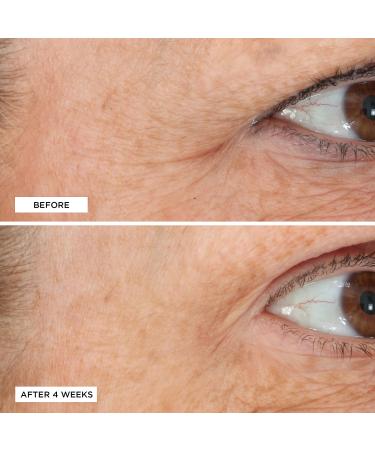 Perricone MD Essential Fx Acyl-Glutathione Eyelid Lift Serum 0.5 oz - Discover Premium Quality Shop now! - Buy Online on GoSupps.com