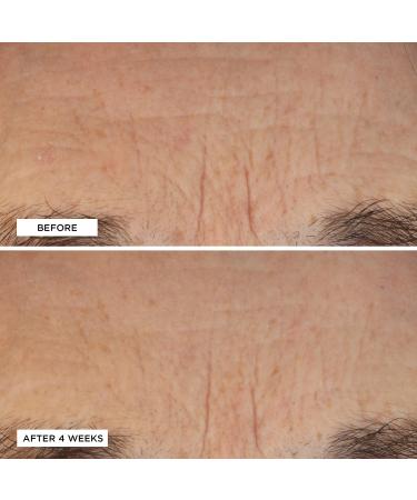 Discover Perricone MD Essential Fx Acyl-Glutathione Deep Crease Serum 1.0 oz - Elevate Your Style Instantly! - Buy Online on GoSupps.com