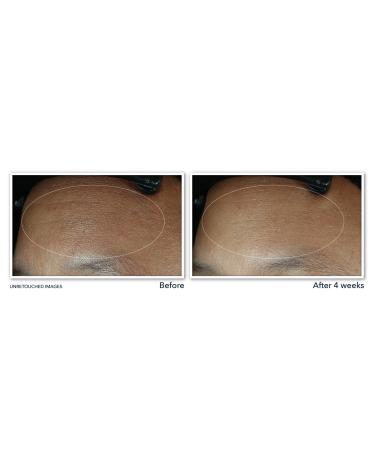 RoC Retinol Correxion Max Daily Hydration Creme Fragrance-Free - Discover Premium Quality Shop now! - Buy Online on GoSupps.com