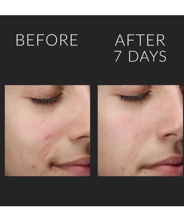 Kate Somerville Liquid ExfoliKate Triple Acid Resurfacing Treatment 4.0 oz - Discover Premium Quality Shop now! - Buy Online on GoSupps.com