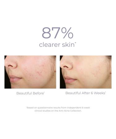 DERMA E Acne Deep Pore Salicylic Acid Cleansing Wash 6.0 oz - Transform Your Style with the Best Innovation Today! - Buy Online on GoSupps.com