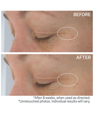 StriVectin Hyaluronic Tripeptide Gel-Cream for Eyes 0.5 oz - Transform Your Style with the Best Innovation Today! - Buy Online on GoSupps.com