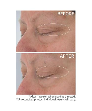 StriVectin Hyaluronic Tripeptide Gel-Cream for Eyes 0.5 oz - Transform Your Style with the Best Innovation Today! - Buy Online on GoSupps.com