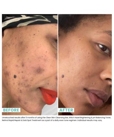 Urban Skin Rx Retinol Rapid Repair & Dark Spot Treatment 1.0 oz - Transform Your Style with the Best Innovation Today! - Buy Online on GoSupps.com