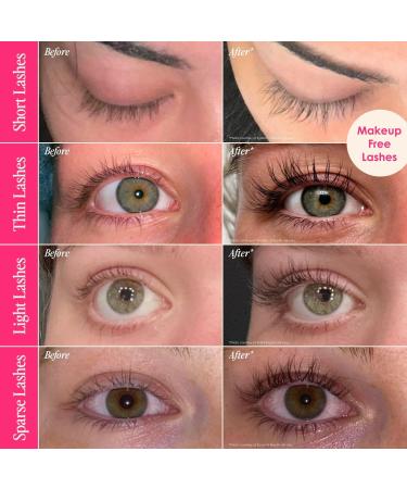 Discover Grande Cosmetics GrandeLASH-MD Lash Enhancing Serum (6 Month Supply) 0.14 oz - Elevate Your Style Instantly! - Buy Online on GoSupps.com