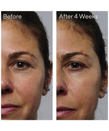 Murad Rapid Collagen Infusion Instant Plumping Treatment 1.0 oz - Discover Premium Quality Shop now! - Buy Online on GoSupps.com