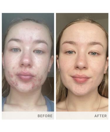Discover jane iredale Skin Accumax Supplement Advanced Nutrition Programme 120 ct - Elevate Your Style Instantly! - Buy Online on GoSupps.com