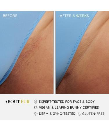 Discover Fur Ingrown Concentrate 0.5 oz - Elevate Your Style Instantly! - Buy Online on GoSupps.com