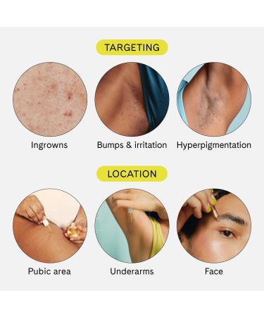 Discover Fur Ingrown Concentrate 0.5 oz - Elevate Your Style Instantly! - Buy Online on GoSupps.com