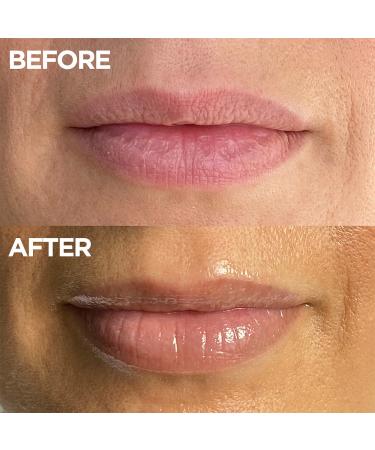 Lanolips The Original 101 Ointment Multipurpose Superbalm .52 oz - Transform Your Style with the Best Innovation Today! - Buy Online on GoSupps.com