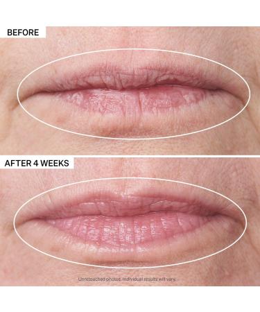 StriVectin Double Fix for Lips Plumping & Vertical Line Treatment .16 oz - Discover Premium Quality Shop now! - Buy Online on GoSupps.com