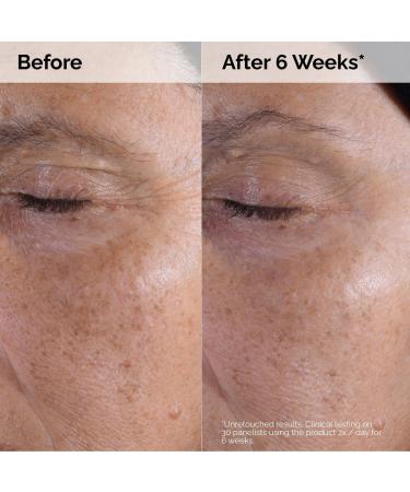 The Ordinary Glycolic Acid 7% Exfoliating Toner 8.0 oz - Transform Your Style with the Best Innovation Today! - Buy Online on GoSupps.com