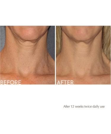 Exuviance Age Reverse Antiaging Toning Neck Cream 4.40 oz - Discover Premium Quality Shop now! - Buy Online on GoSupps.com