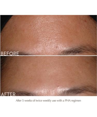 Discover Exuviance Performance Peel AP25 At-Home Facial Peel 13 ct - Elevate Your Style Instantly! - Buy Online on GoSupps.com