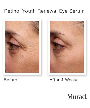 Murad Retinol Youth Renewal Eye Serum 0.5 oz - Transform Your Style with the Best Innovation Today! - Buy Online on GoSupps.com