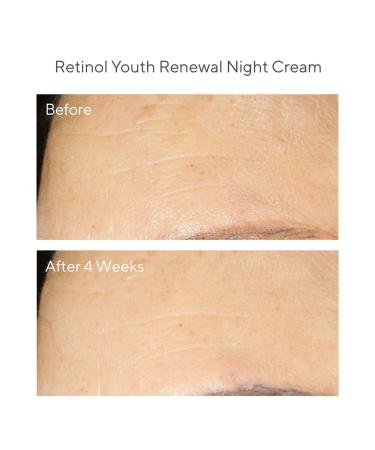 Discover Murad Retinol Youth Renewal Night Cream 1.7 oz - Elevate Your Style Instantly! - Buy Online on GoSupps.com