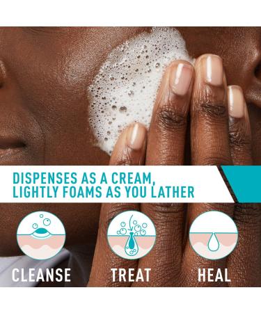 CeraVe Acne Foaming Cream Cleanser with 4% BPO for Acne Prone Skin 5.0 oz - Transform Your Style with the Best Innovation Today! - Buy Online on GoSupps.com