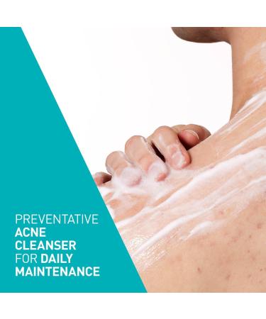 CeraVe Acne Foaming Cream Cleanser with 4% BPO for Acne Prone Skin 5.0 oz - Transform Your Style with the Best Innovation Today! - Buy Online on GoSupps.com