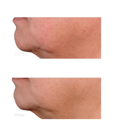 Perricone MD High Potency Growth Factor Firming & Lifting Serum 2.0 oz - Transform Your Style with the Best Innovation Today! - Buy Online on GoSupps.com