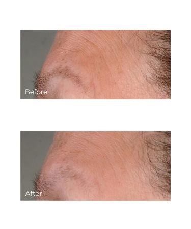 Perricone MD High Potency Growth Factor Firming & Lifting Serum 2.0 oz - Transform Your Style with the Best Innovation Today! - Buy Online on GoSupps.com