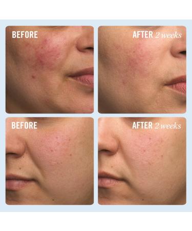 Discover First Aid Beauty Travel Size Ultra Repair Cream Intense Hydration 2.0 oz - Elevate Your Style Instantly! - Buy Online on GoSupps.com