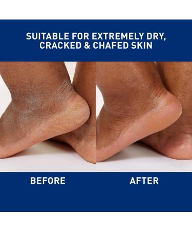 Discover CeraVe Healing Ointment to Help Protect & Soothe Dry to Very Dry Skin 3.0 oz - Elevate Your Style Instantly! - Buy Online on GoSupps.com
