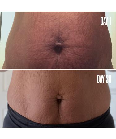 Discover MAÃ‹LYS B-FLAT Belly Firming Cream 3.38 oz - Elevate Your Style Instantly! - Buy Online on GoSupps.com