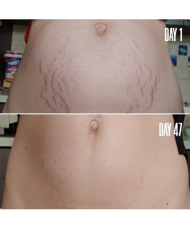 Discover MAÃ‹LYS B-FLAT Belly Firming Cream 3.38 oz - Elevate Your Style Instantly! - Buy Online on GoSupps.com
