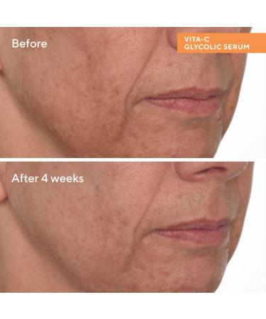 Murad Vitamin C Glycolic Brightening Serum 1.0 oz - Transform Your Style with the Best Innovation Today! - Buy Online on GoSupps.com