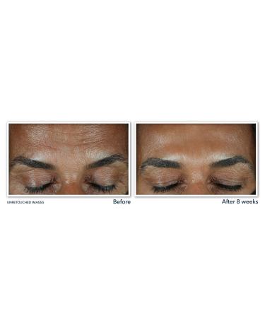 RoC Vitamin C Brightening Serum for Dark Spots & Uneven Tone 1.0 oz - Discover Premium Quality Shop now! - Buy Online on GoSupps.com