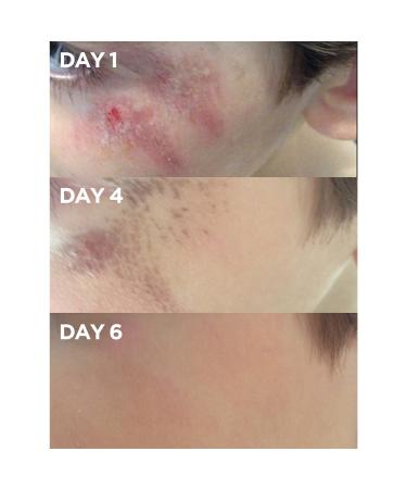 Lanolips Golden Dry Skin Salve 0.88 oz - Transform Your Style with the Best Innovation Today! - Buy Online on GoSupps.com