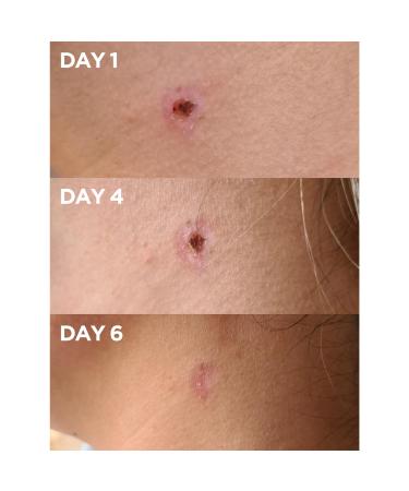 Lanolips Golden Dry Skin Salve 0.88 oz - Transform Your Style with the Best Innovation Today! - Buy Online on GoSupps.com