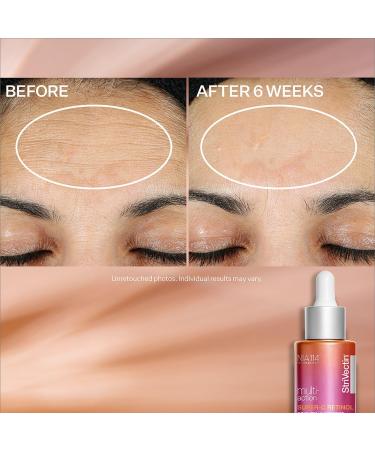 Discover StriVectin Super-C Retinol Brighten & Correct Vitamin C Serum 1.0 oz - Elevate Your Style Instantly! - Buy Online on GoSupps.com