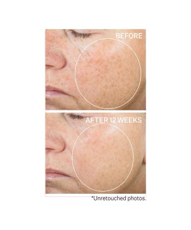 Discover StriVectin Super-C Retinol Brighten & Correct Vitamin C Serum 1.0 oz - Elevate Your Style Instantly! - Buy Online on GoSupps.com