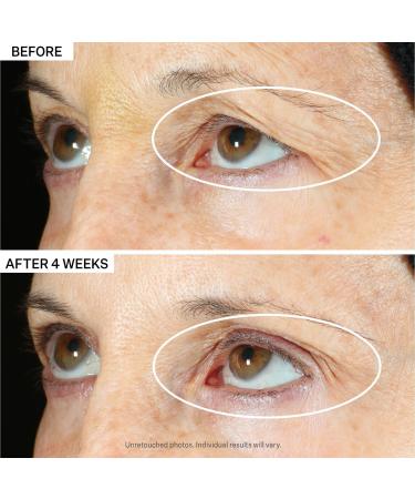 Discover StriVectin Peptight 360 Tightening Eye Serum 1.0 oz - Elevate Your Style Instantly! - Buy Online on GoSupps.com