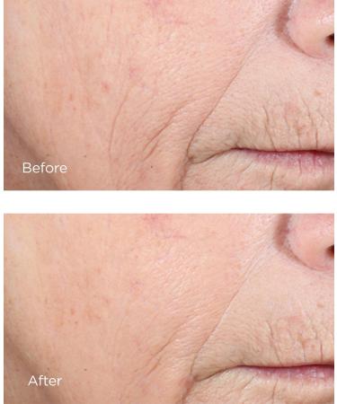 Discover Perricone MD Vitamin C Ester CCC+ Ferulic Brightening Complex 20% 2.0 oz - Elevate Your Style Instantly! - Buy Online on GoSupps.com