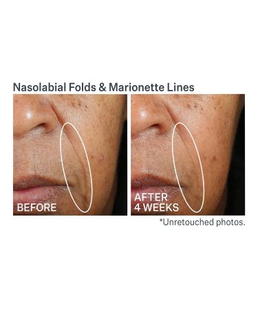 Discover StriVectin Wrinkle Recode Moisture Rich Barrier Cream 1.7 oz - Elevate Your Style Instantly! - Buy Online on GoSupps.com