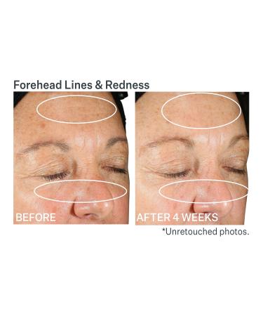 Discover StriVectin Wrinkle Recode Moisture Rich Barrier Cream 1.7 oz - Elevate Your Style Instantly! - Buy Online on GoSupps.com